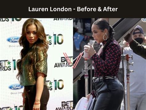 Celebrities with BBL Before and After Photos